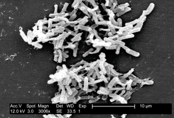 Imagen: Microgotografía electrónica de barrido (SEM) de la bacteria, Clostridium difficile, obtenida de una muestra de heces (Fotografía cortesía de los Centros para el Control de Enfermedades de EUA).